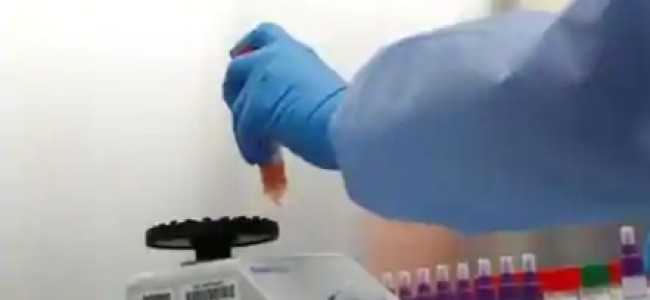 Glenmark starts clinical trials for potential Covid-19 drug in India Glenmark starts clinical trials for potential Covid-19 drug in India