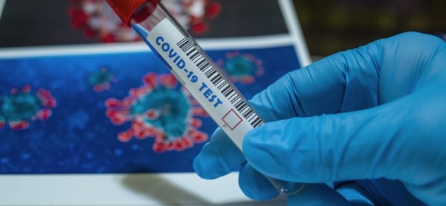 COVID-19: 246 test positive in J-K, total 8675 COVID-19: 246 test positive in J-K, total 8675