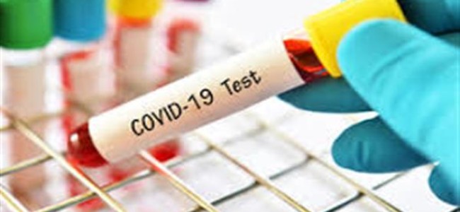 J&K Reports 452 Covid-19 Cases, No Death J&K Reports 452 Covid-19 Cases, No Death