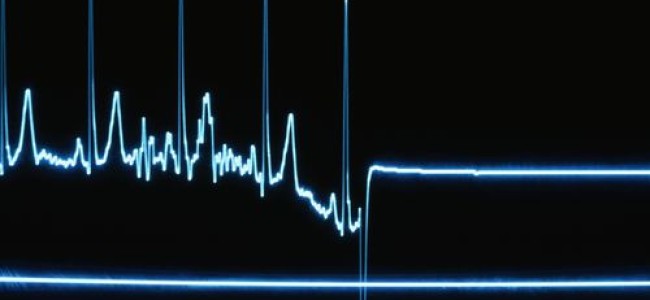 Srinagar doctor dies of cardiac arrest in south Kashmir