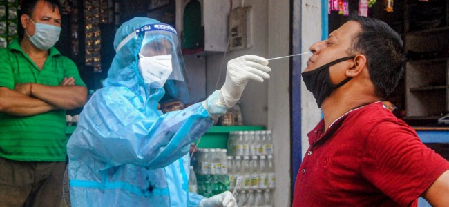 Screen all TB patients for Covid and Covid patients for TB, says health ministry Screen all TB patients for Covid and Covid patients for TB, says health ministry