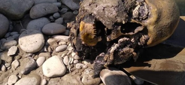 Decomposed human skull recovered from Ganderbal Decomposed human skull recovered from Ganderbal